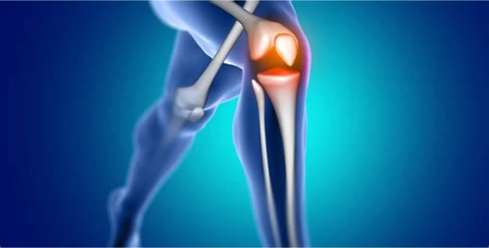 Knee replacement surgery in narayanpur