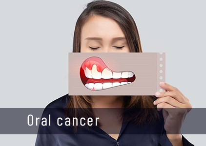 Oral cancer hospital in durg
