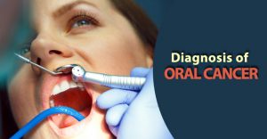 Oral cancer hospital in rajnandgaon