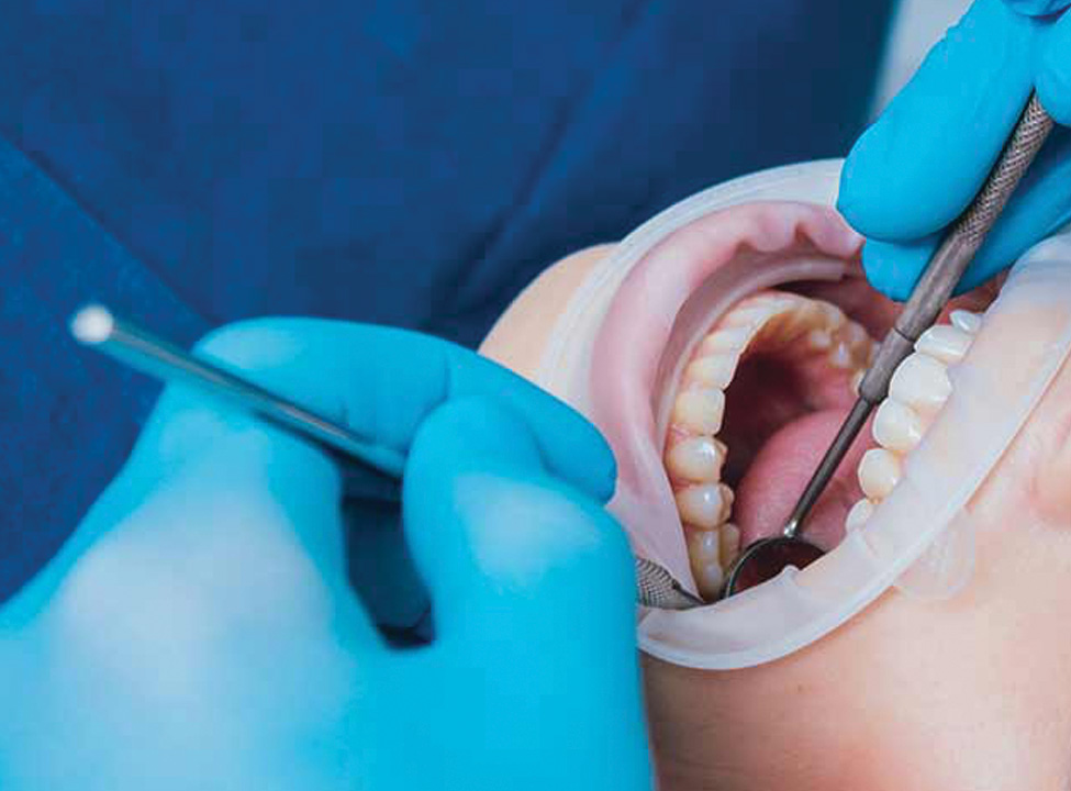 Oral cancer specialist in ambikapur