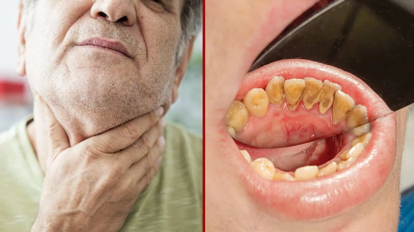 Oral cancer specialist in chirmiri