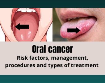 Oral cancer specialist in dhamtiri