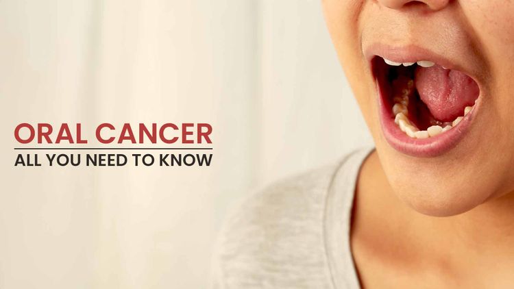 Oral cancer specialist in jagdalpur