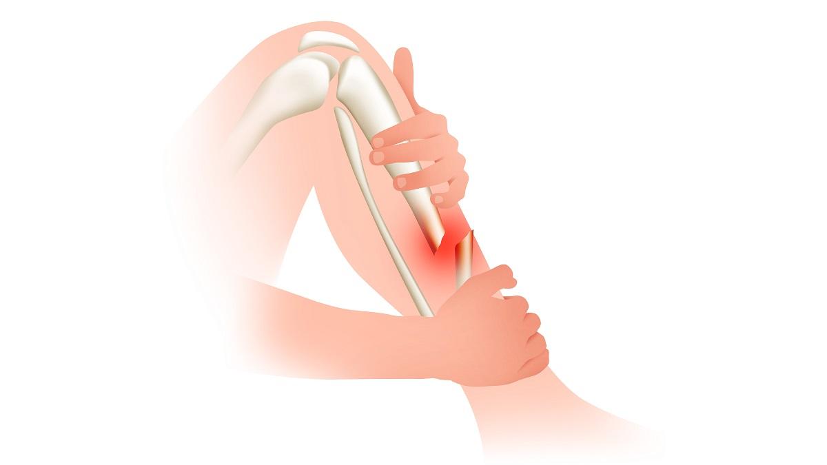 Orthopedic fracture and accidental hospital in dhamtari