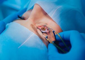 Best Eye Surgery Specialist Doctor in Raigarh