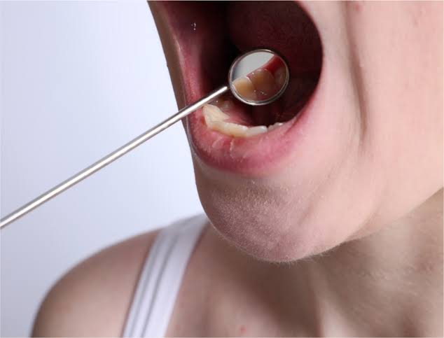 Best Oral Cancer Hospital in Bhilai