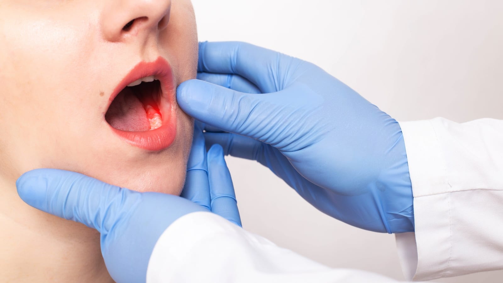 Best Oral Cancer Hospital in Narsinghpur