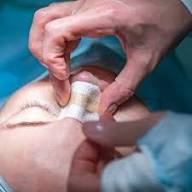 Best Plastic Surgery Specialist Doctor in Balaghat
