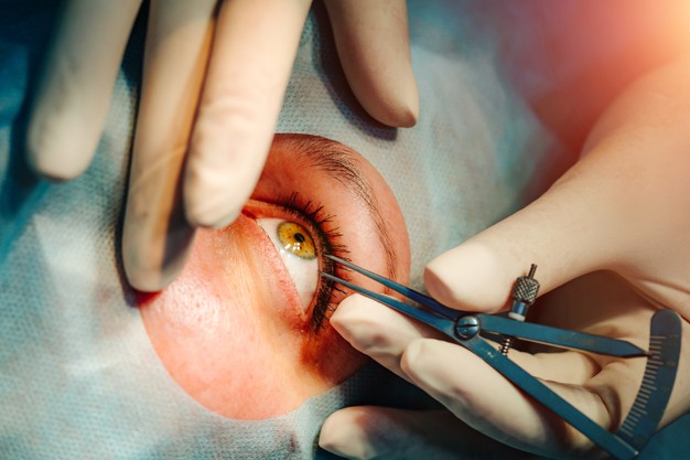 Eye Oculoplastic Surgery Specialist In Nagpur