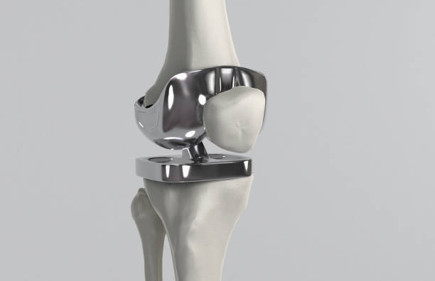 Joint Replacement Surgery Specialist in Bilaspur