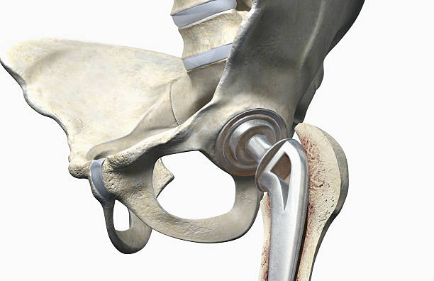 Joint Replacement Surgery Specialist in Bilaspur