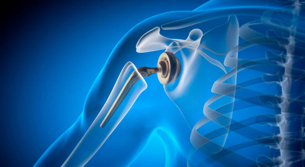 Joint Replacement Surgery Specialist in Maihar