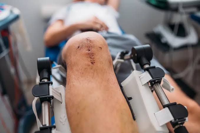 Joint Replacement Surgery Specialist in Shajapur