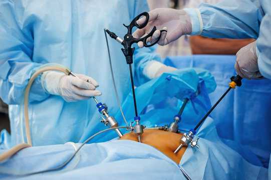 Laparoscopic Surgery Specialist In Nagpur