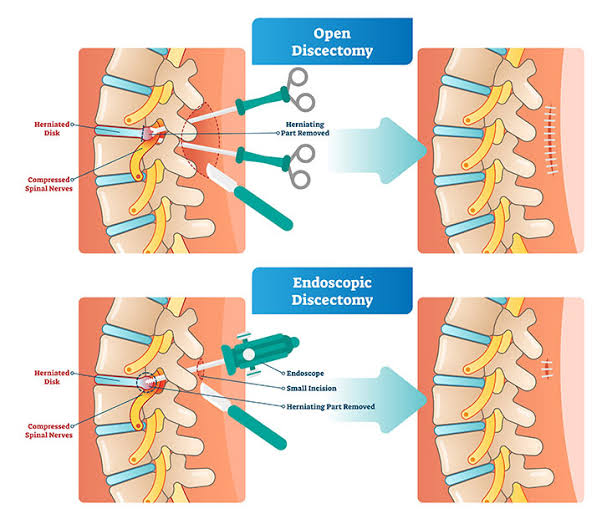 Neuro & Spine Surgery Specialist Hospital in Durg