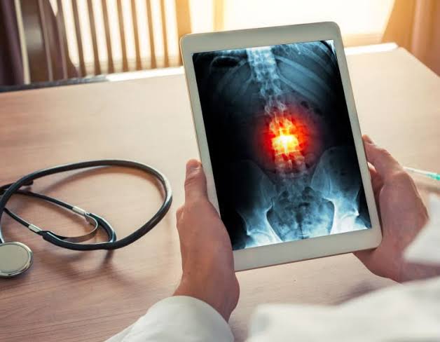 Neuro & Spine Surgery Specialist Hospital in Narsinghpur