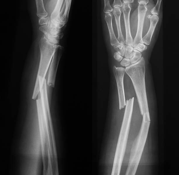 Orthopedic, Fracture & Accidental Hospital in Dhamtari