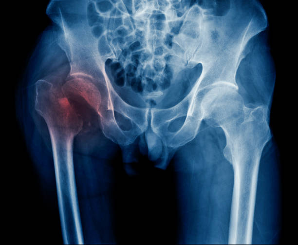 Orthopedic, Fracture & Accidental Hospital in Shajapur