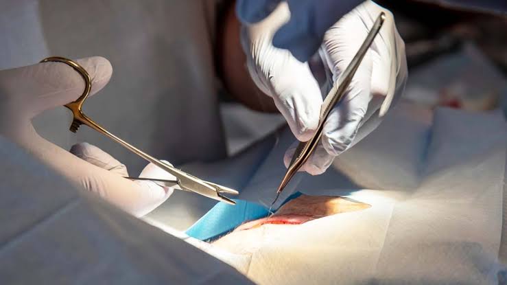 Best Cancer Surgery Specialist in Morena