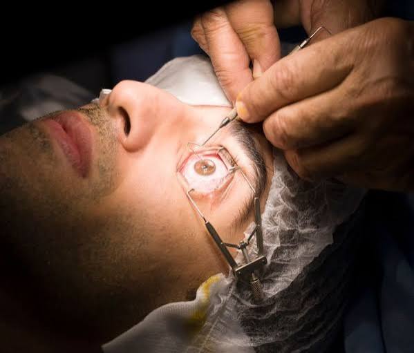 Best Eye Surgery Specialist Doctor in Guna