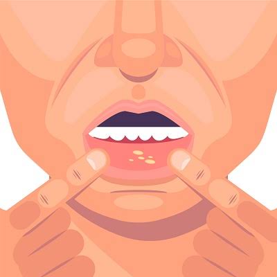 Best Oral Cancer Hospital in Shivpuri