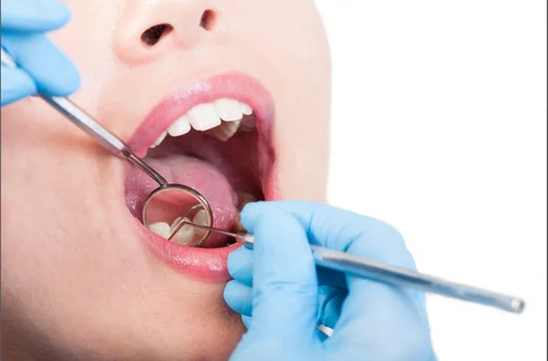 Best oral cancer hospital in jabalpur