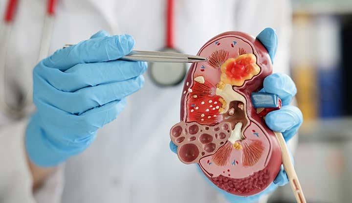 Gastro & Kidney Care Specialist Hospital in Ratlam
