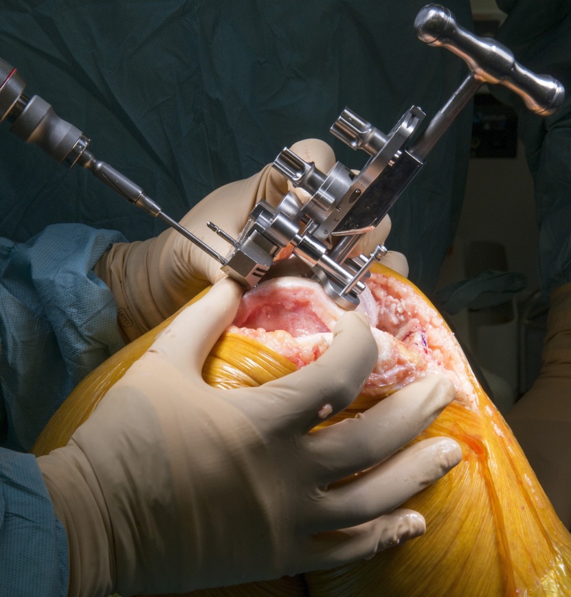 Joint Replacement Surgery Specialist in Betul