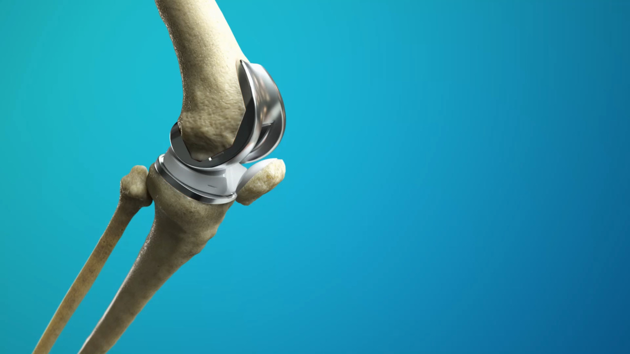 Joint Replacement Surgery Specialist in Chhindwara