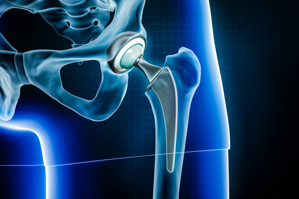 Joint Replacement Surgery Specialist in Damoh