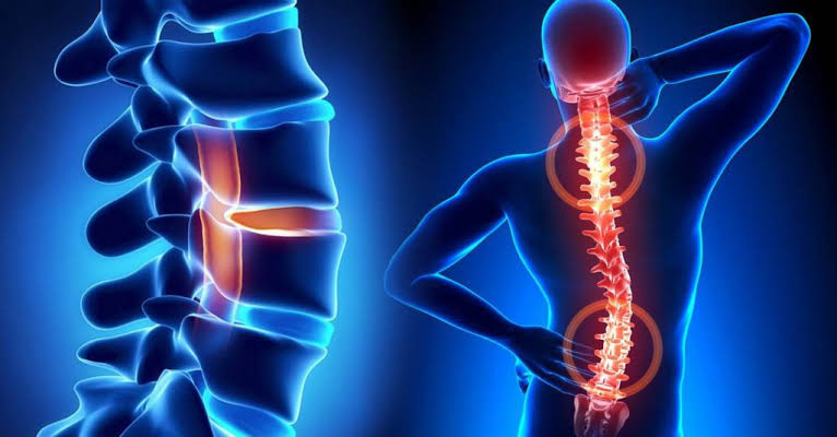 Neuro & Spine Surgery Specialist Hospital in Shivpuri