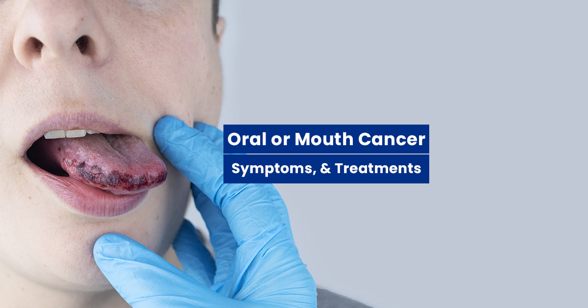 Oral cancer hospital in bhopal
