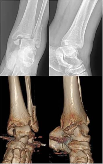 Orthopedic, Fracture & Accidental Hospital in Chhatarpur