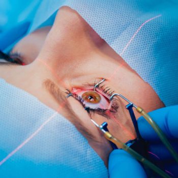 Best eye surgery specialist doctor in buldhana