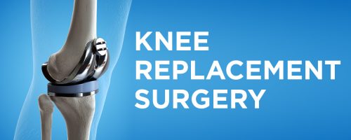 Knee replacement in sheopur